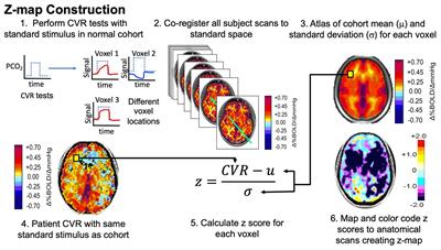 Cerebrovascular Reactivity Assays Collateral Function in Carotid Stenosis